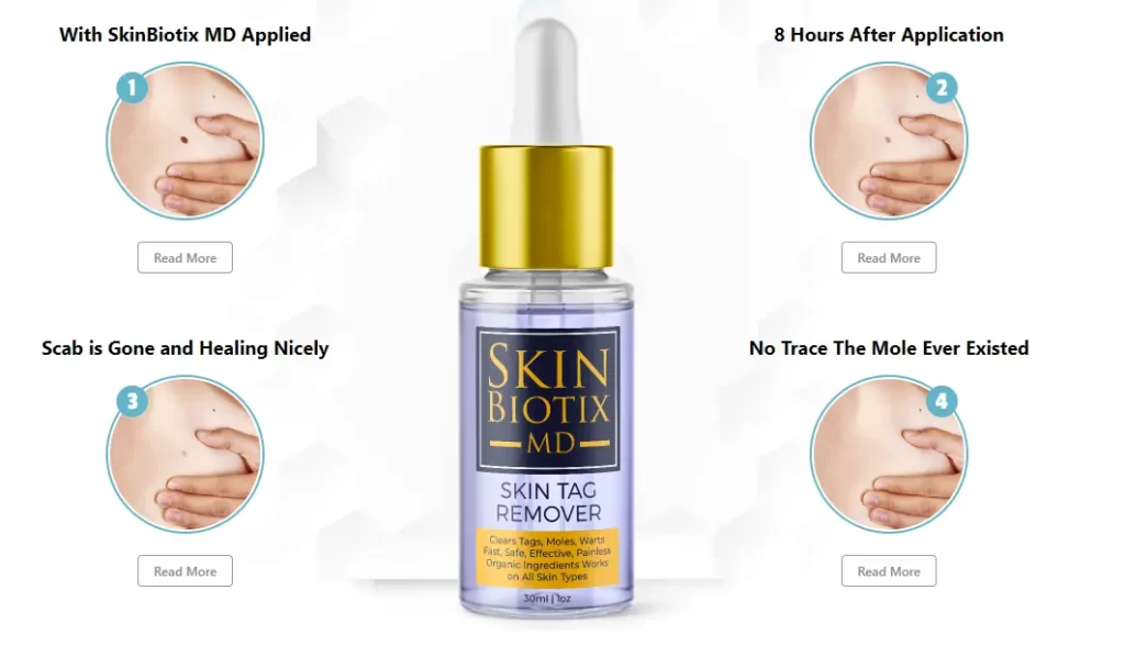 Silky Skin Tag Remover-how-it-works